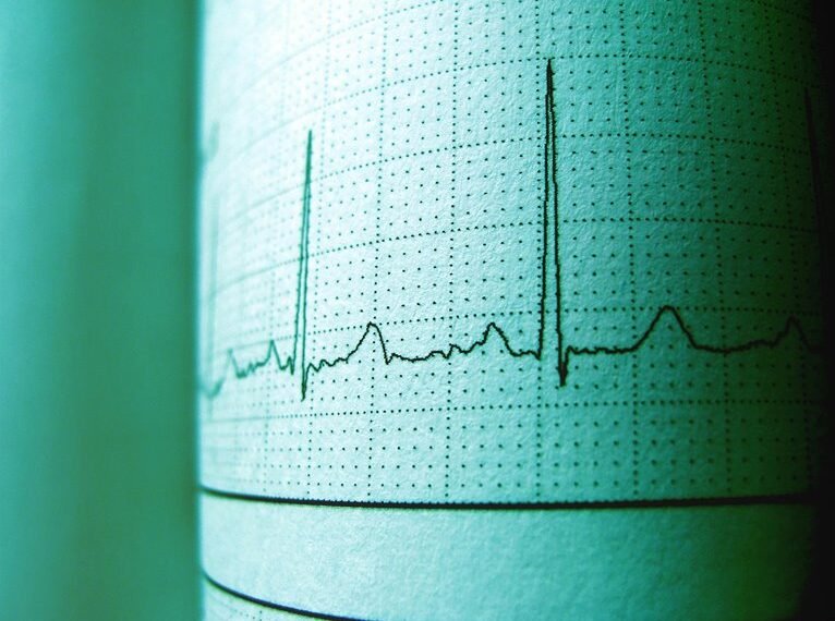 trace call for details